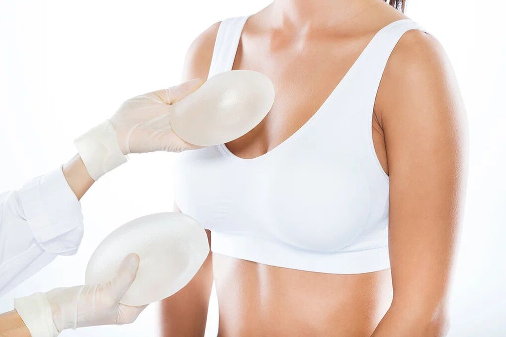 Selección de implantes antes da cirurxía de aumento mamario