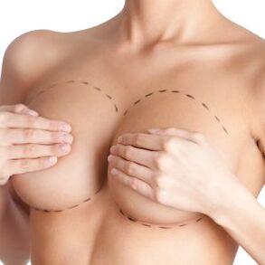 Tipos de implantes