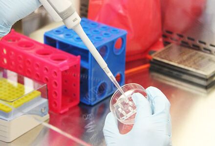 Exame das probas do paciente antes de realizar a mamoplastia de aumento