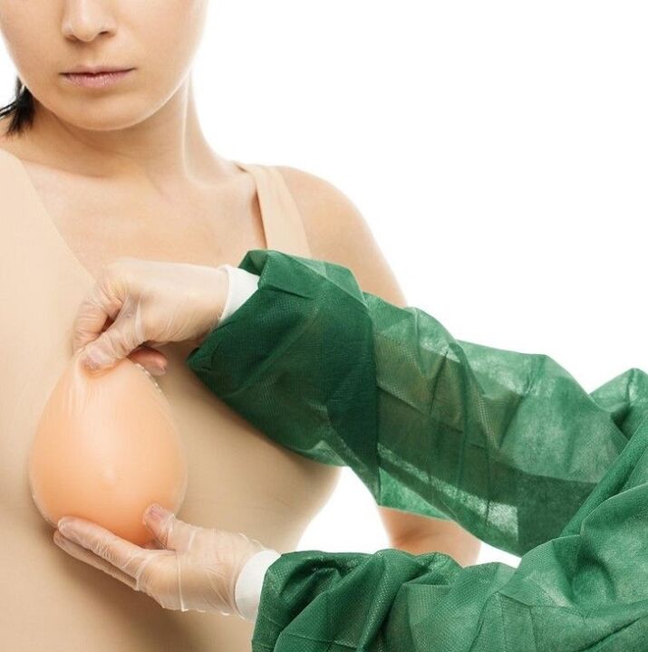implantes de aumento mamario